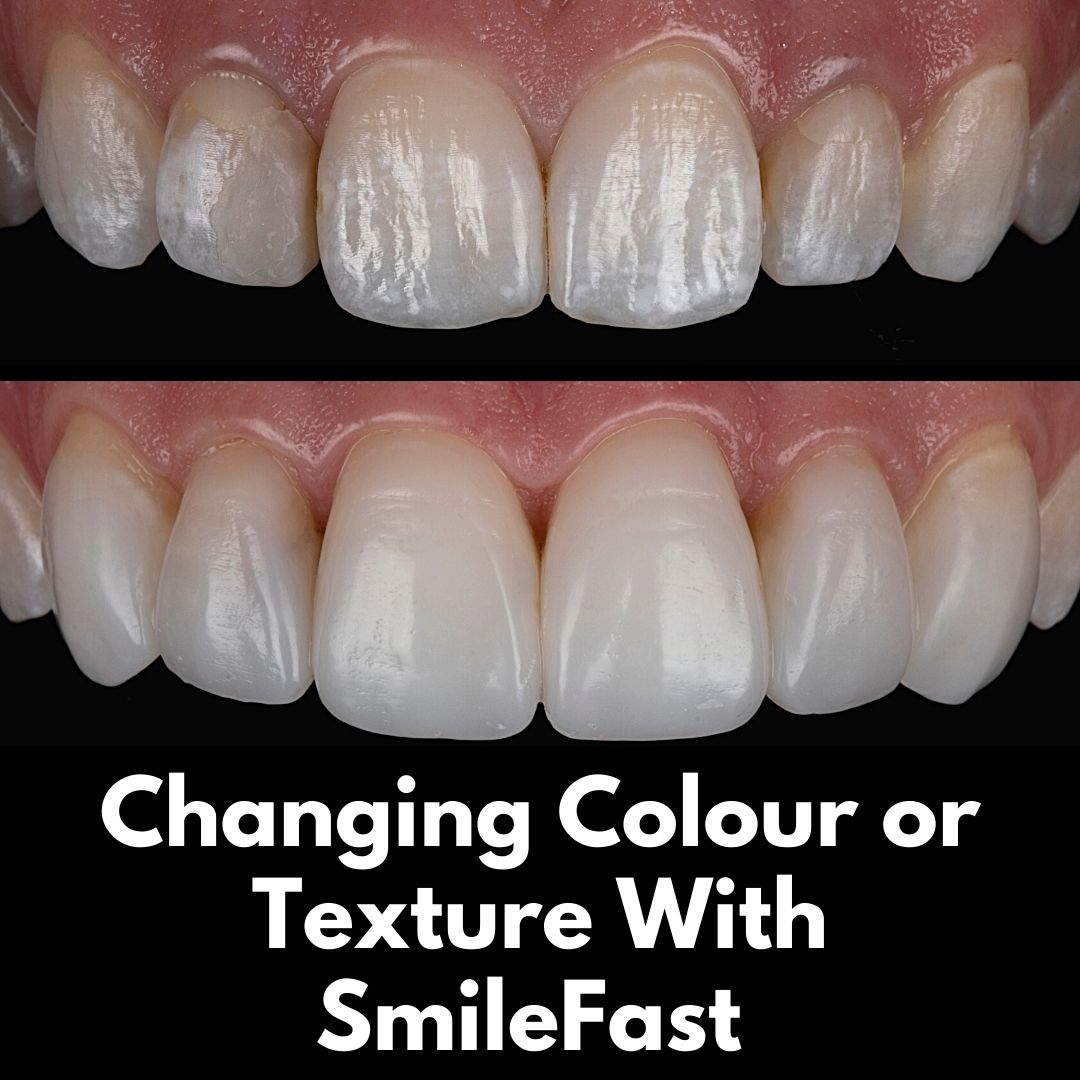 The Hollies Dental Practice SmileFast