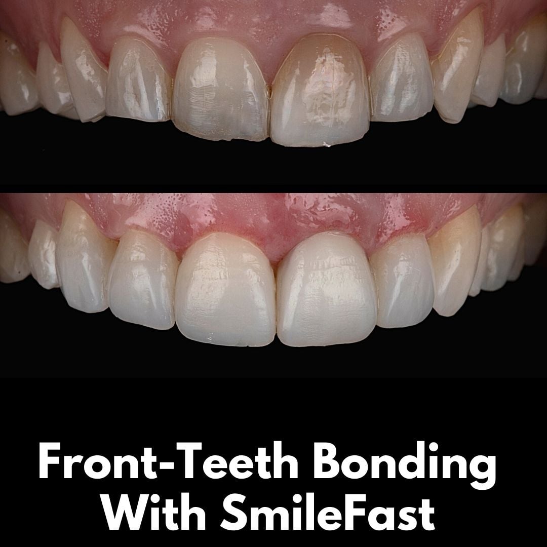 The Hollies Dental Practice SmileFast