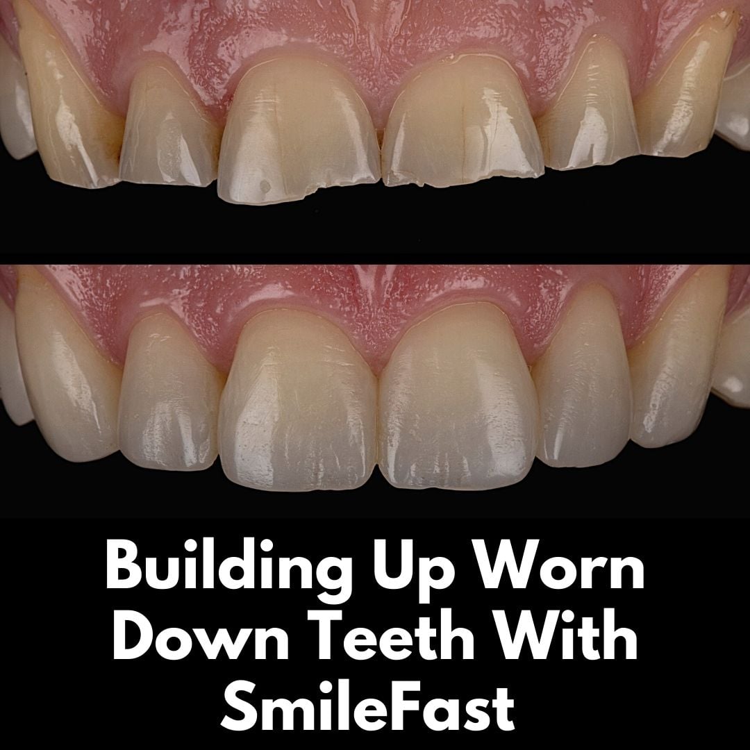 The Hollies Dental Practice SmileFast
