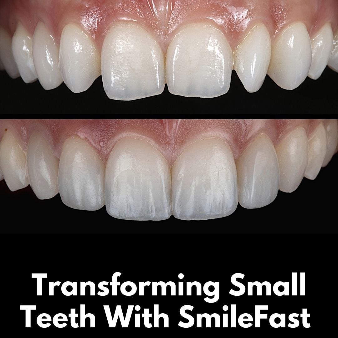 The Hollies Dental Practice SmileFast