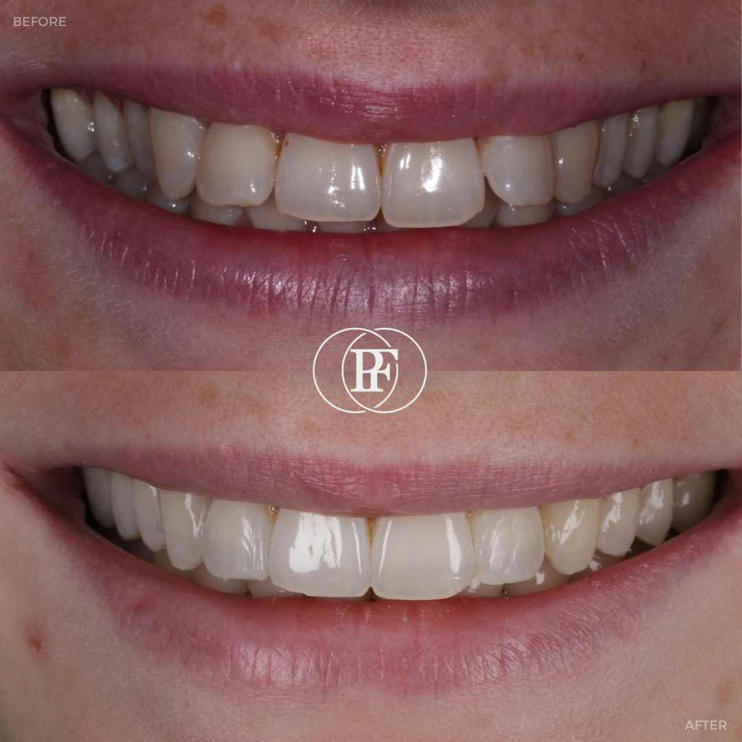 The Hollies Dental Practice Smile Gallery The Hollies Dental Practice Smile Gallery