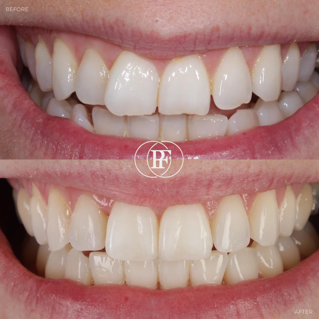 The Hollies Dental Practice Smile Gallery The Hollies Dental Practice Smile Gallery