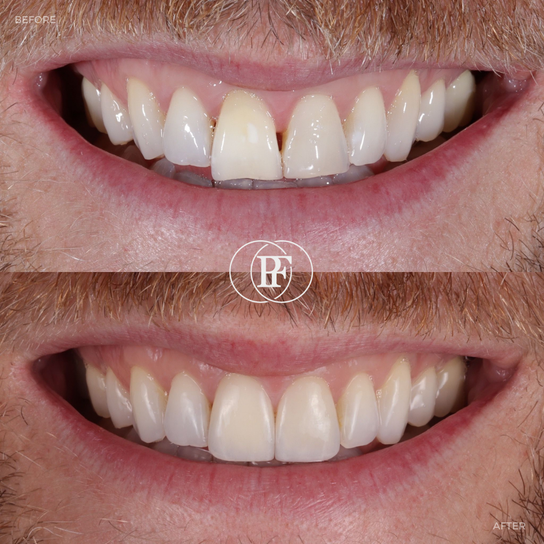 The Hollies Dental Practice Smile Gallery The Hollies Dental Practice Smile Gallery