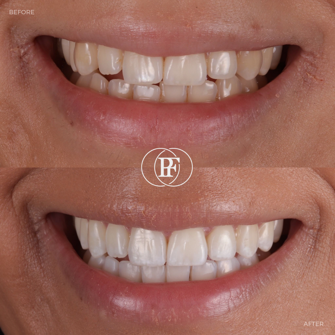 The Hollies Dental Practice Smile Gallery The Hollies Dental Practice Smile Gallery