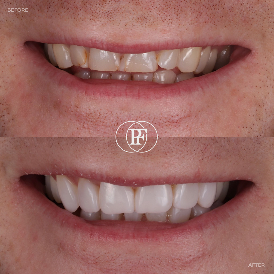 The Hollies Dental Practice Smile Gallery The Hollies Dental Practice Smile Gallery