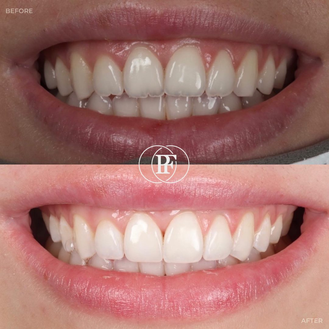 The Hollies Dental Practice Smile Gallery The Hollies Dental Practice Smile Gallery