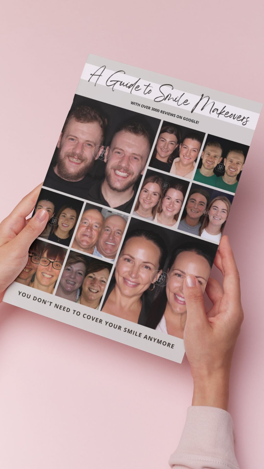 The Hollies Dental Practice Smile Makeovers in Dunoon Download our Smile Makeover Guide