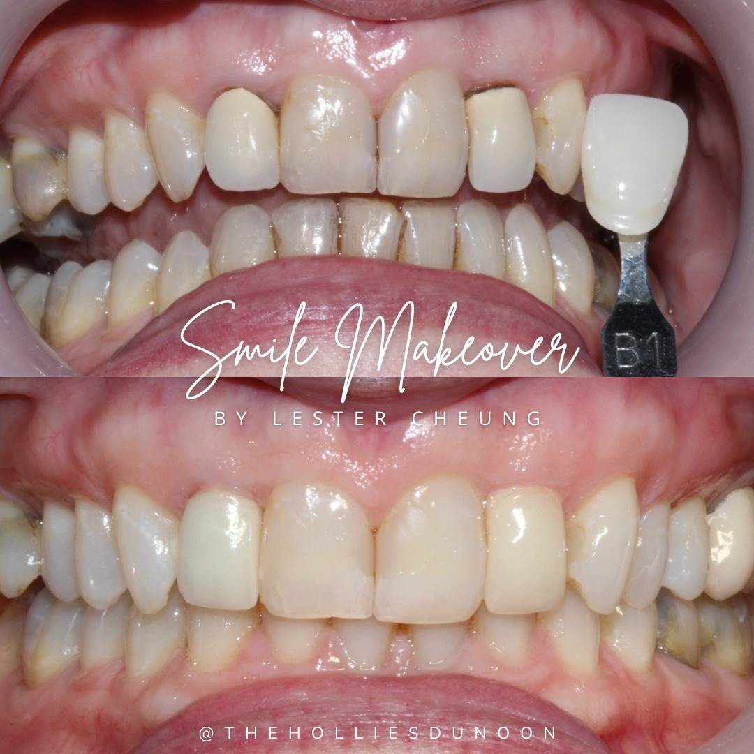 The Hollies Dental Practice Smile Makeovers in Dunoon The Hollies Dental Practice Smile Makeovers in Dunoon