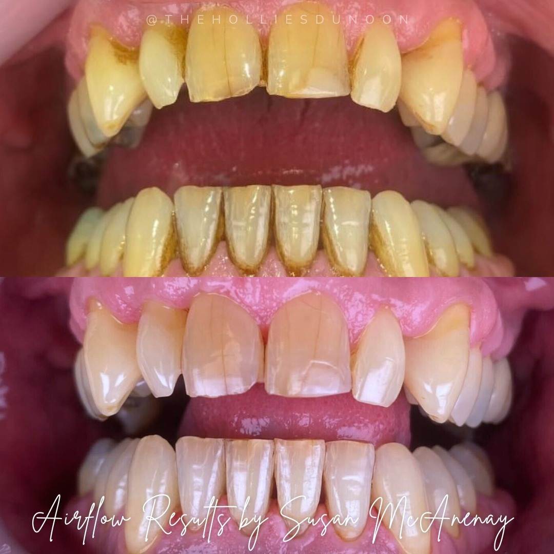 The Hollies Dental Practice Dental Hygiene The Hollies Dental Practice Dental Hygiene