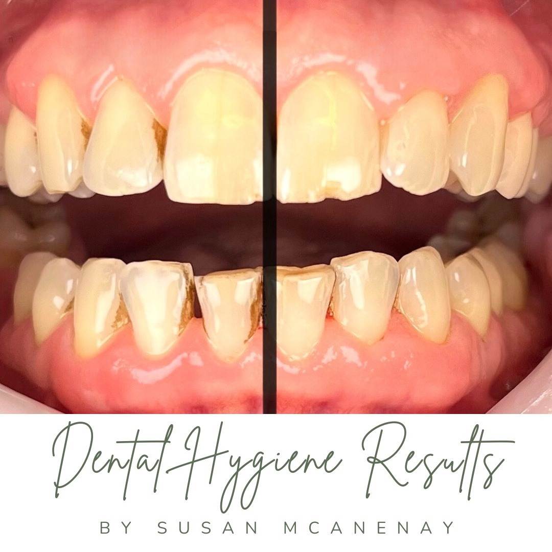 The Hollies Dental Practice Dental Hygiene The Hollies Dental Practice Dental Hygiene