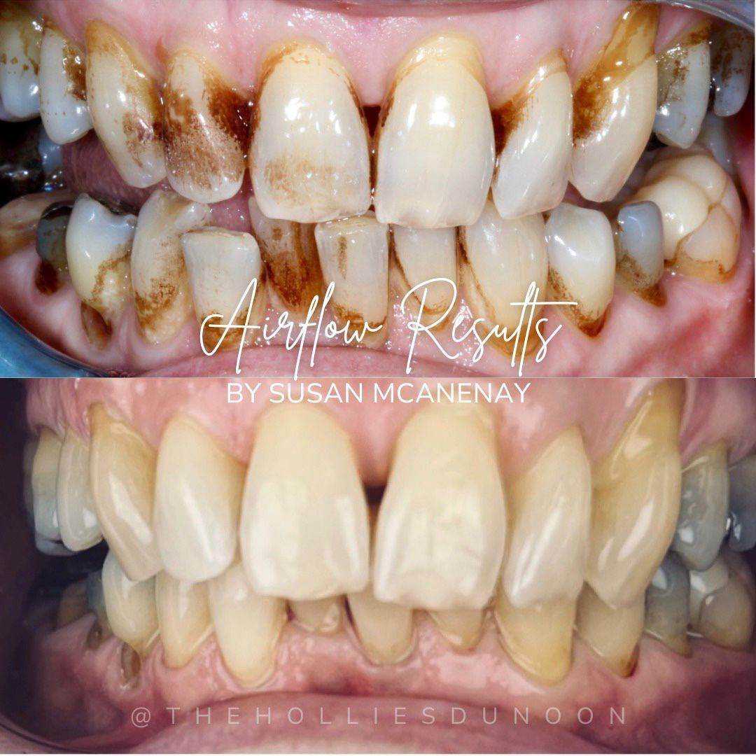 The Hollies Dental Practice Dental Hygiene The Hollies Dental Practice Dental Hygiene