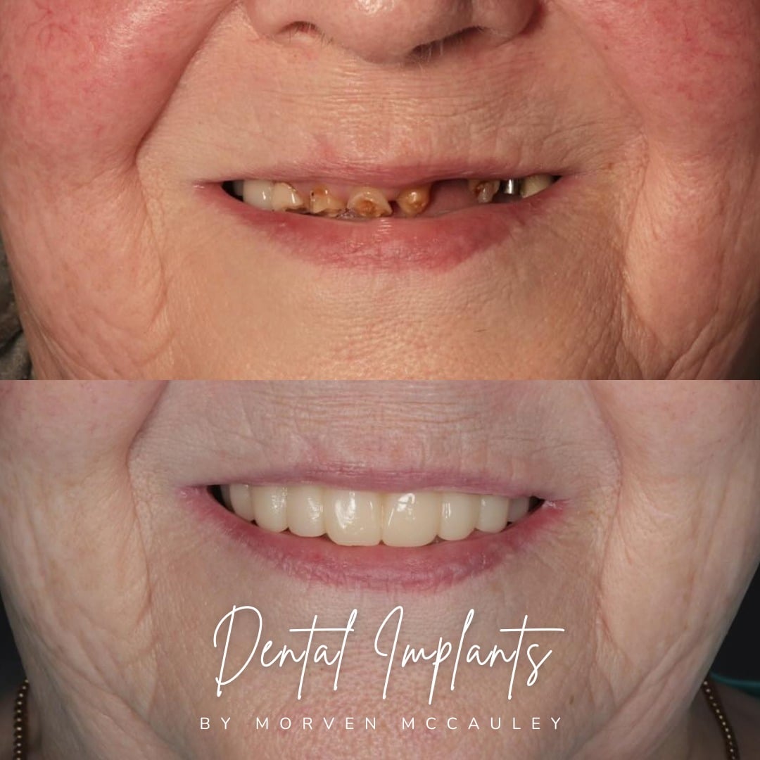 The Hollies Dental Practice Dental Implants Dunoon The Hollies Dental Practice Dental Implants Dunoon