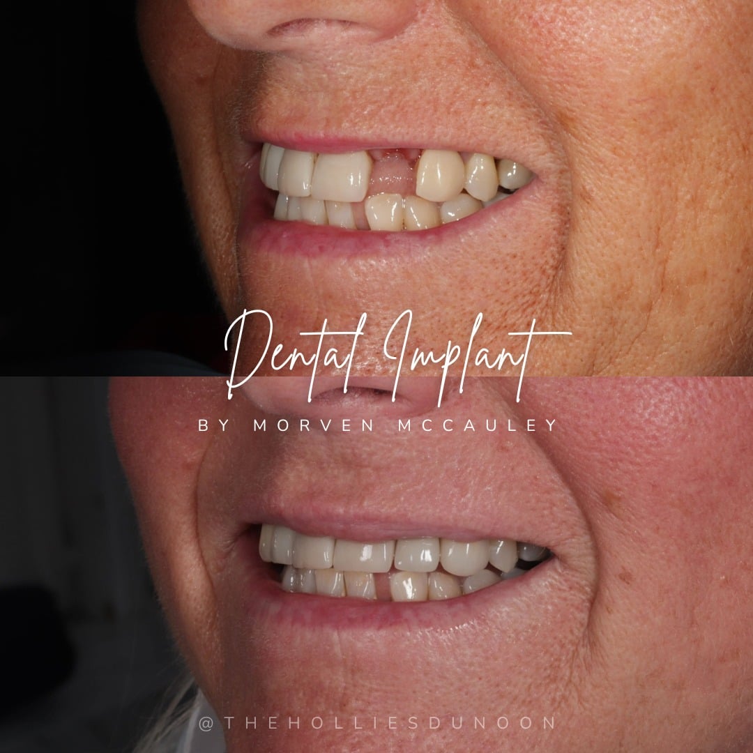 The Hollies Dental Practice Dental Implants Dunoon The Hollies Dental Practice Dental Implants Dunoon