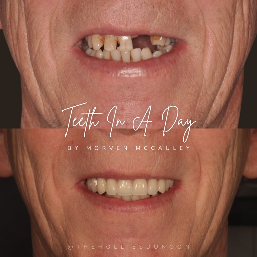 The Hollies Dental Practice Dental Implants Dunoon The Hollies Dental Practice Dental Implants Dunoon
