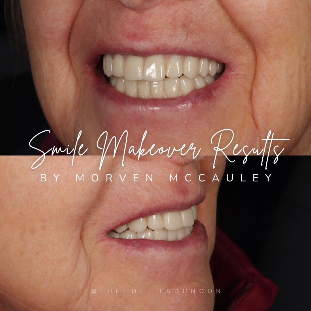 The Hollies Dental Practice Dental Implants Dunoon The Hollies Dental Practice Dental Implants Dunoon