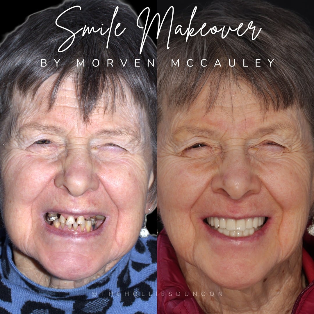 The Hollies Dental Practice Dental Implants Dunoon The Hollies Dental Practice Dental Implants Dunoon