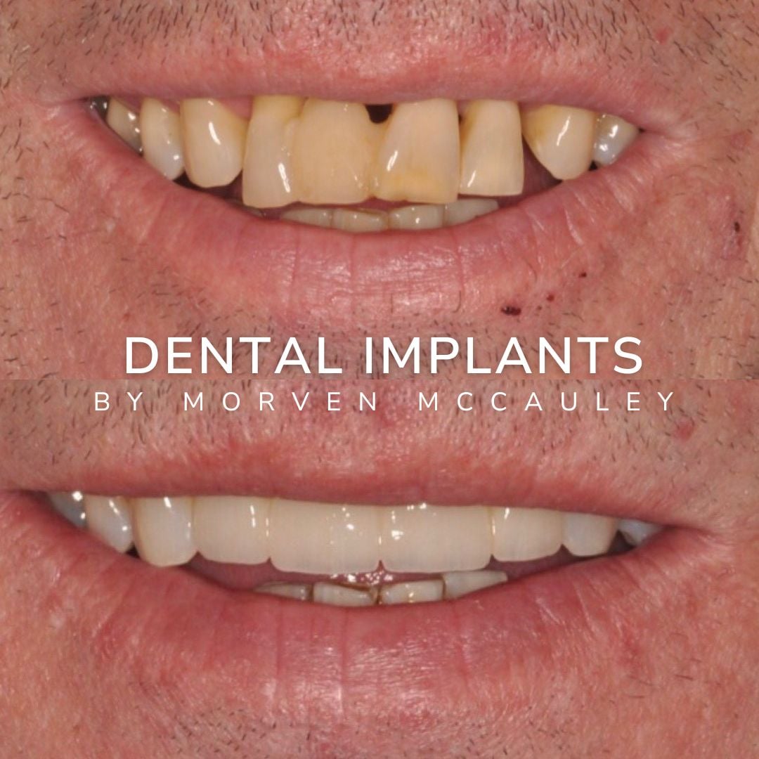 The Hollies Dental Practice Dental Implants Dunoon The Hollies Dental Practice Dental Implants Dunoon