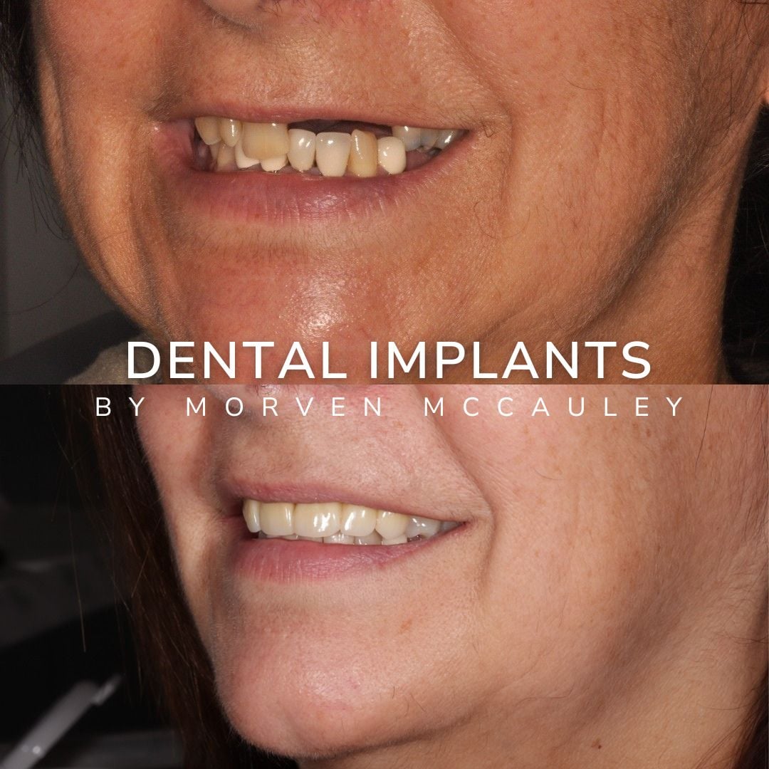The Hollies Dental Practice Dental Implants Dunoon The Hollies Dental Practice Dental Implants Dunoon