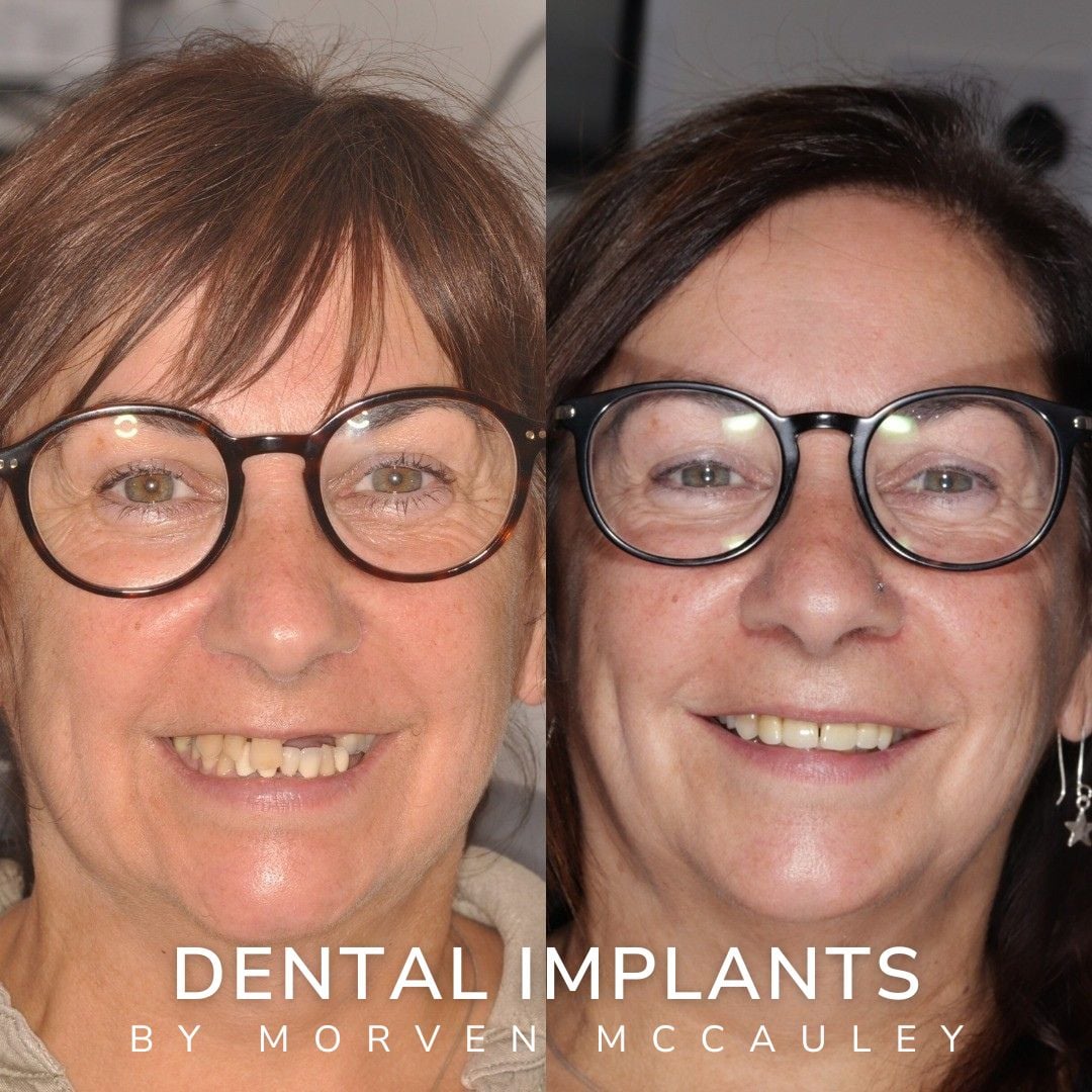 The Hollies Dental Practice Dental Implants Dunoon The Hollies Dental Practice Dental Implants Dunoon
