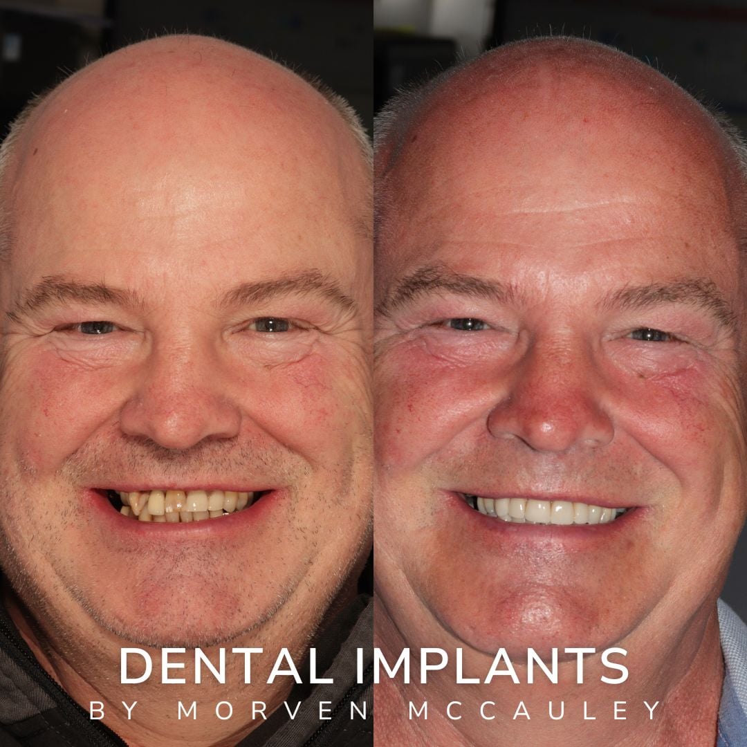 The Hollies Dental Practice Dental Implants Dunoon The Hollies Dental Practice Dental Implants Dunoon