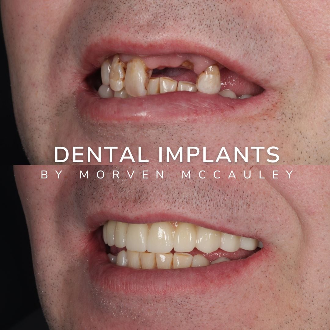 The Hollies Dental Practice Dental Implants Dunoon The Hollies Dental Practice Dental Implants Dunoon