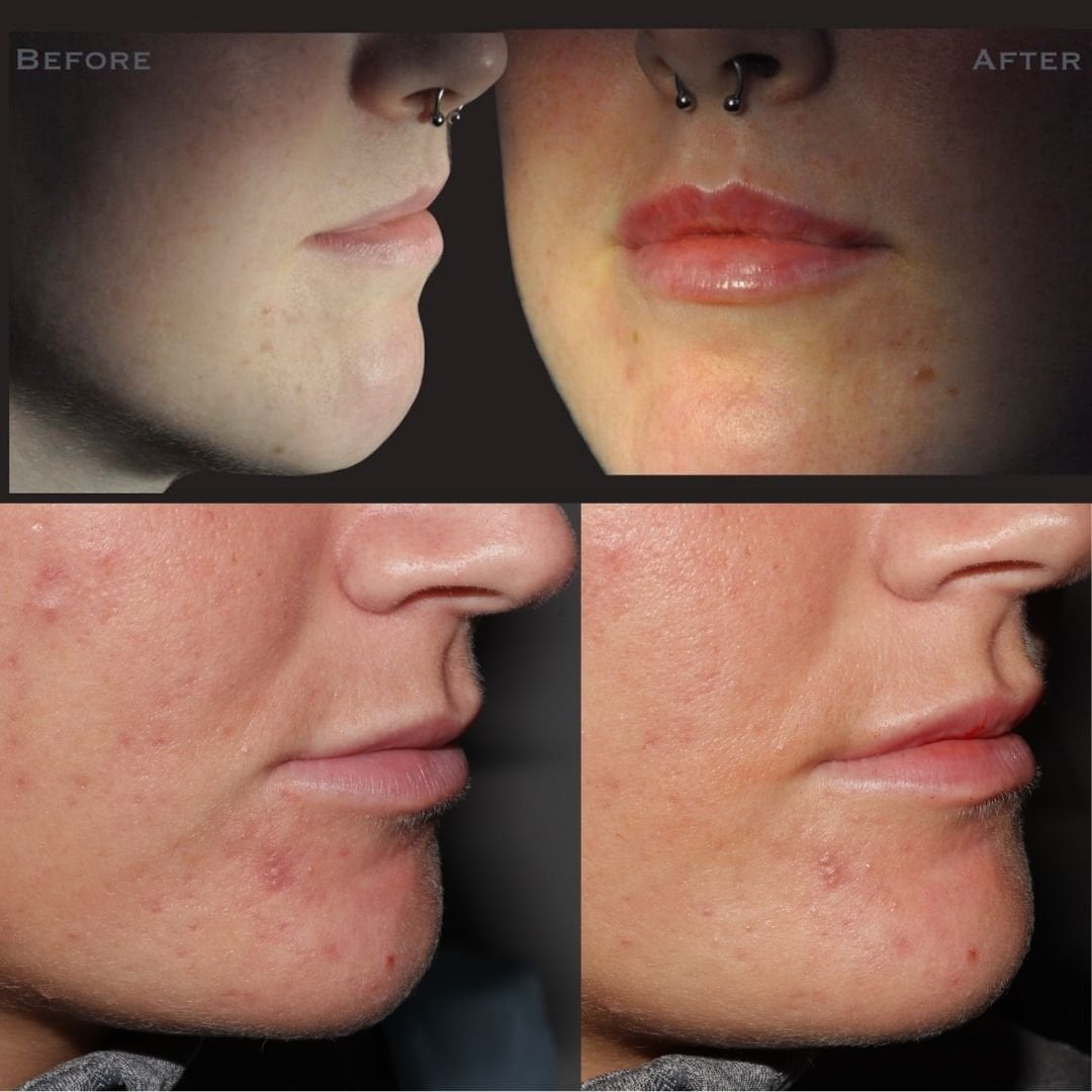 The Hollies Dental Practice Face and Beauty Before and after treatment