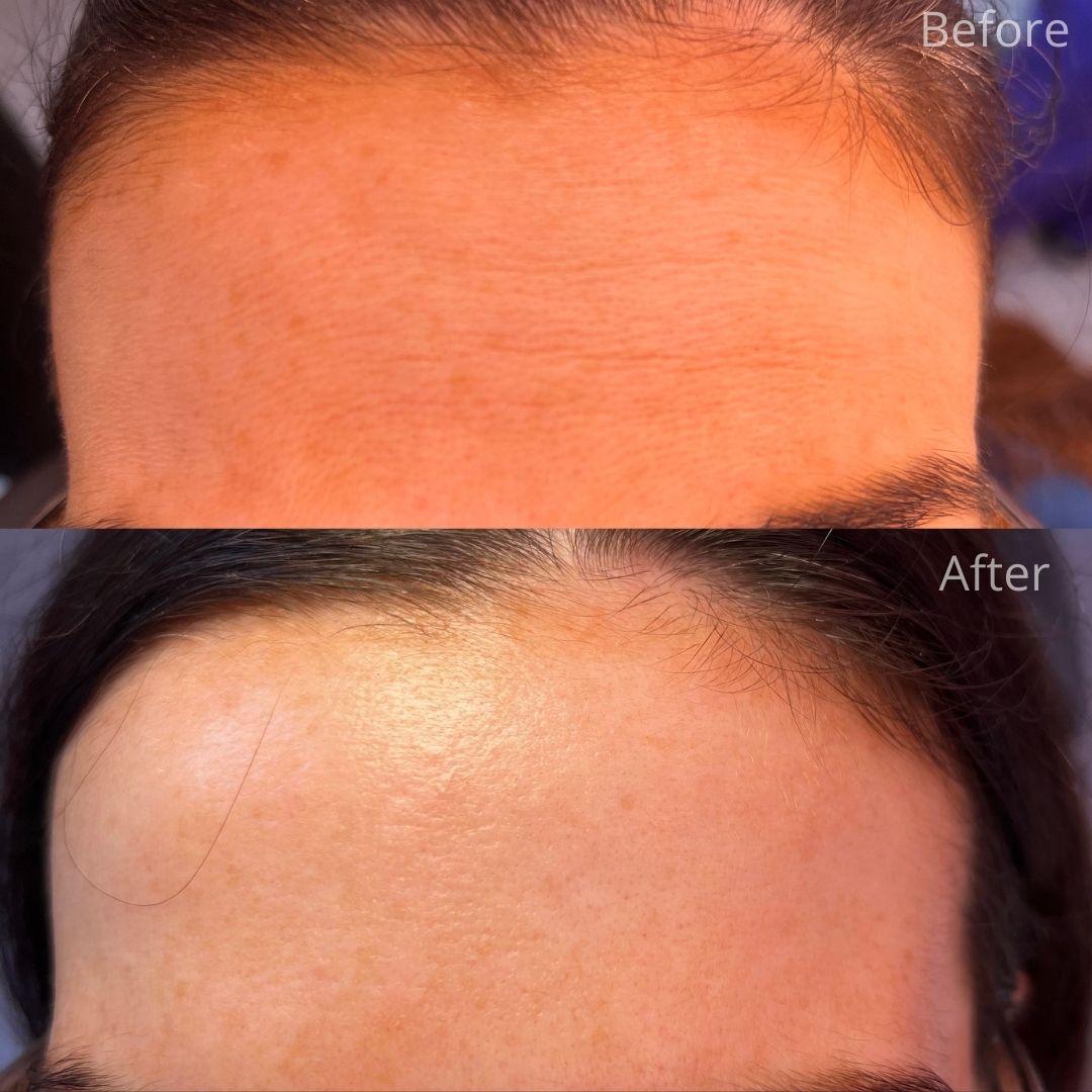 The Hollies Dental Practice Face and Beauty Before and after treatment
