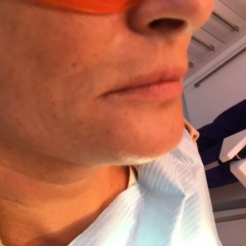 The Hollies Dental Practice Face and Beauty The Hollies Dental Practice Face and Beauty