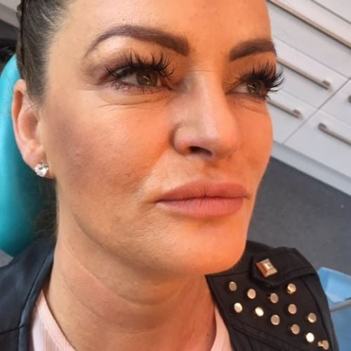 The Hollies Dental Practice Face and Beauty The Hollies Dental Practice Face and Beauty