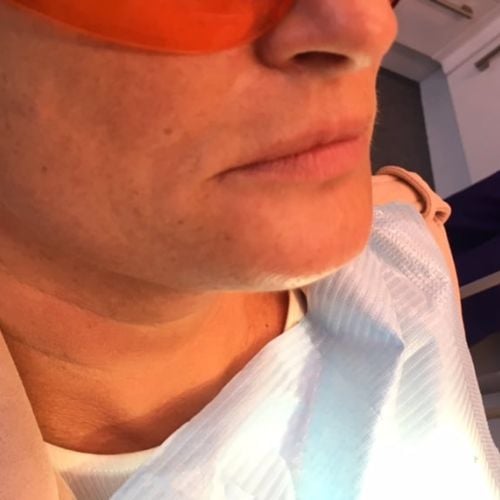 The Hollies Dental Practice Face and Beauty The Hollies Dental Practice Face and Beauty