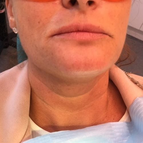 The Hollies Dental Practice Face and Beauty The Hollies Dental Practice Face and Beauty